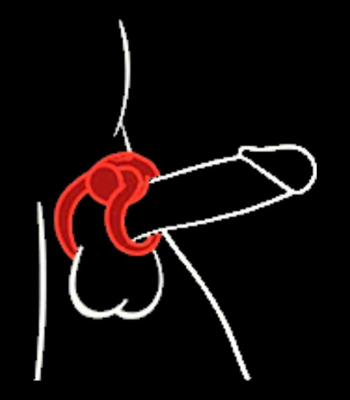 FirmTech Performance Ring